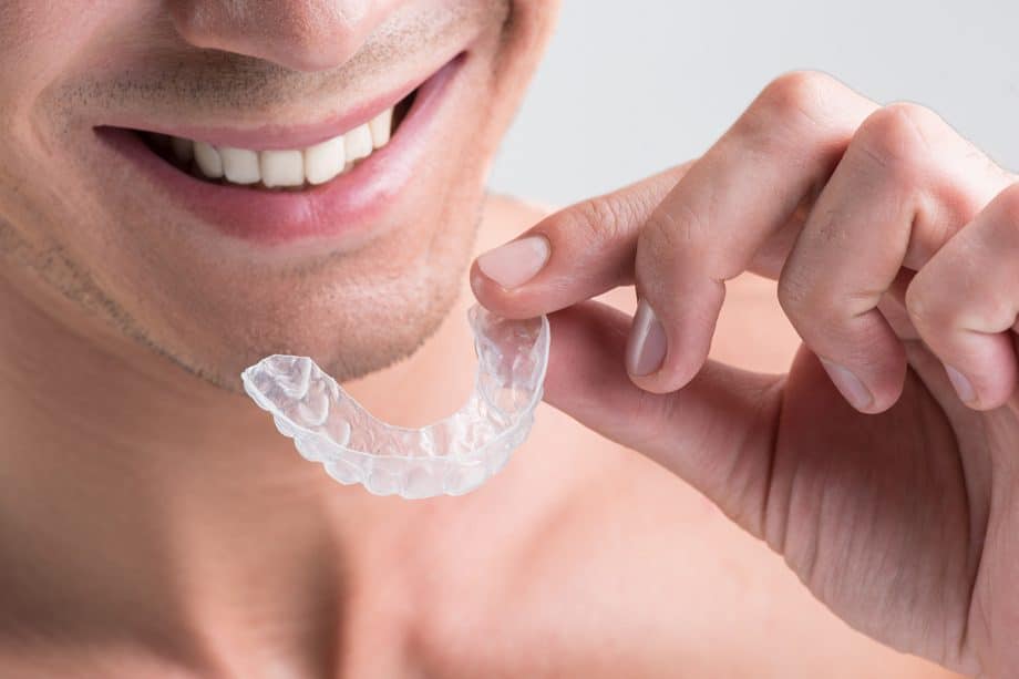 Are Clear Aligners Right for Me?