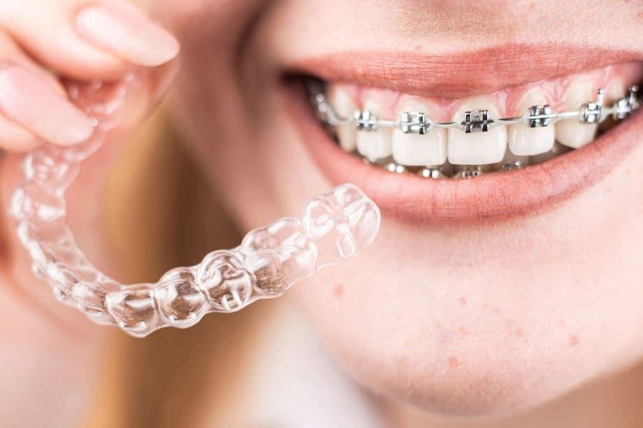 Are clear braces as effective as metal braces?